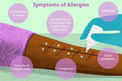 blood test for allergies